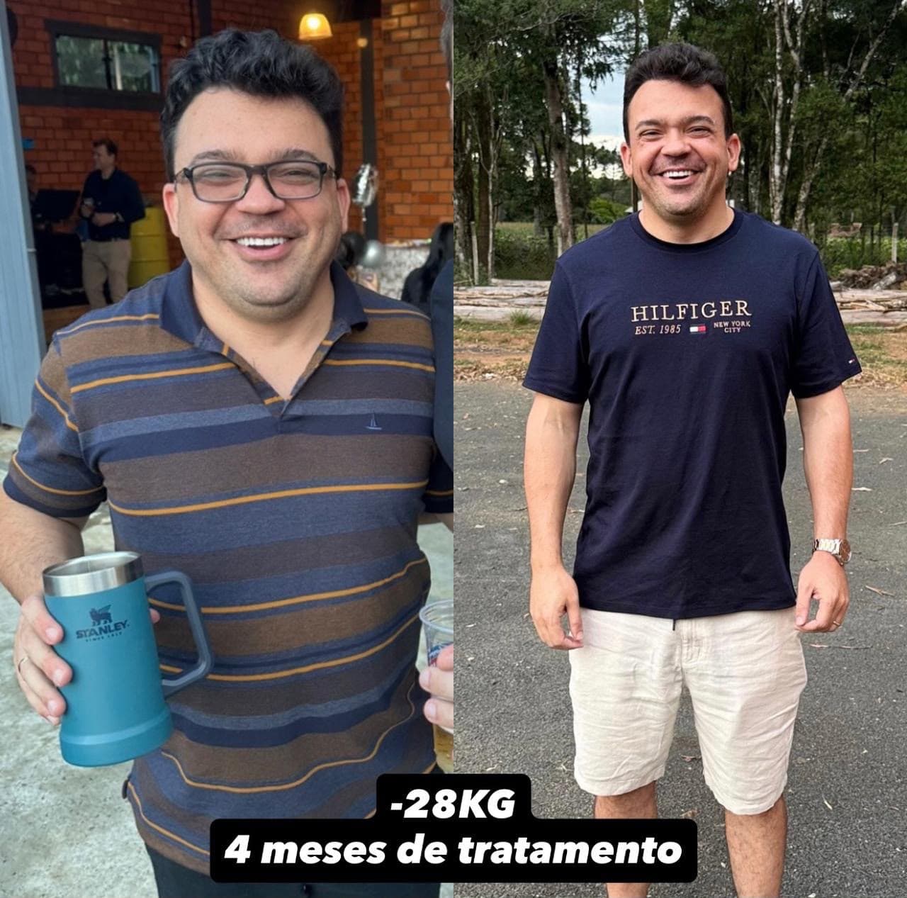 Evolução visual de Alberto Carlos