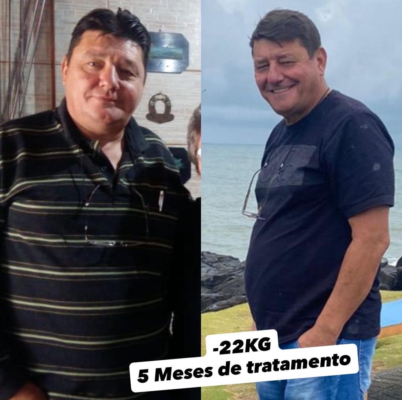 Evolução visual de César Krull