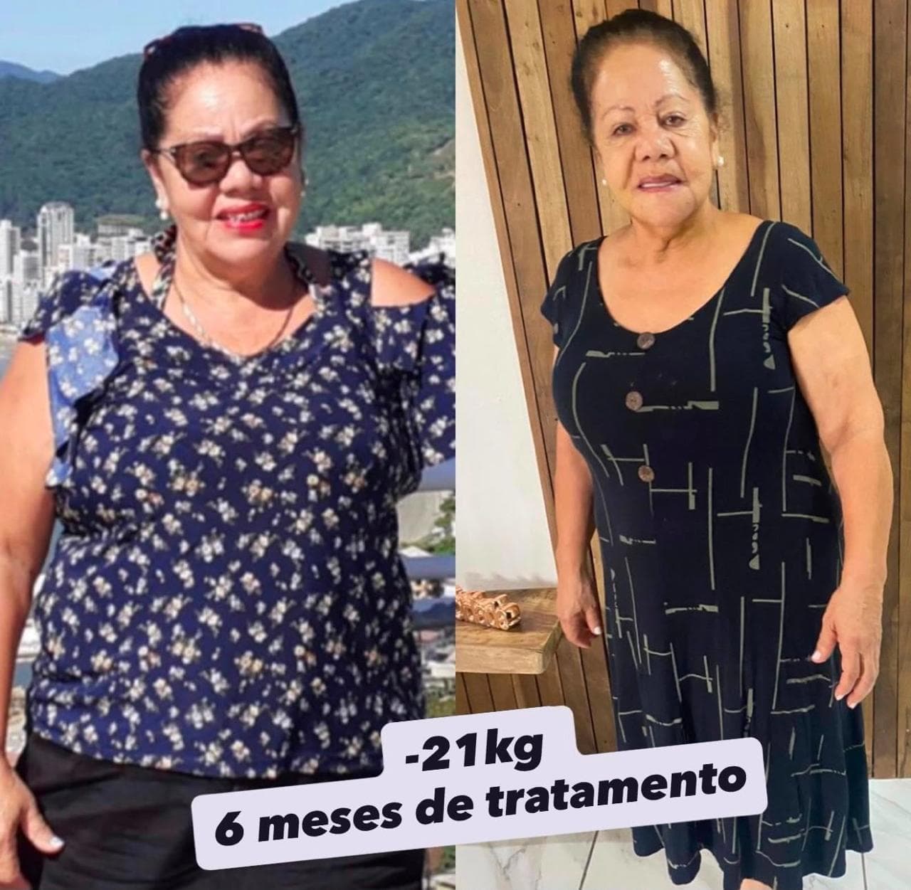 Evolução visual de Silvia Krull